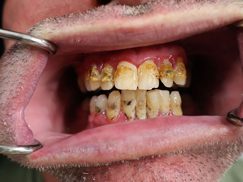 Before1 | Restore Dental Arts